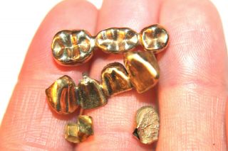 Dental Scrap Gold 10.  5 Grams