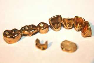 Dental Scrap Gold 10.  5 Grams 2