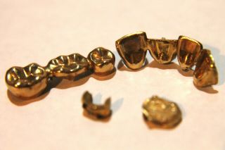Dental Scrap Gold 10.  5 Grams 3