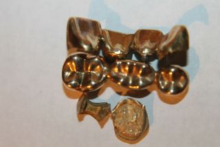 Dental Scrap Gold 10.  5 Grams 4