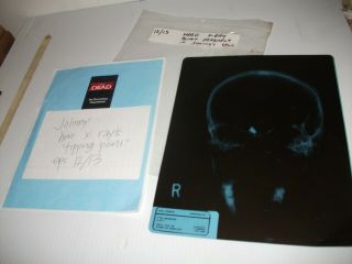 The Dead Zone - Tv Series - Prop - X - Ray For " John Smith "