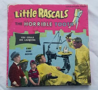 Little Rascals The Horrible Tooth Vintage 8mm Film Movie Ken Films 231